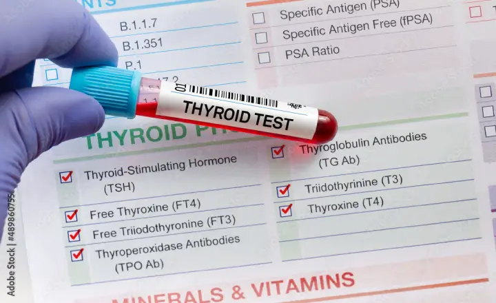 آمادگی های لازم قبل آزمایش تیروئید