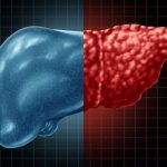 متابولیسم چربی در کبد