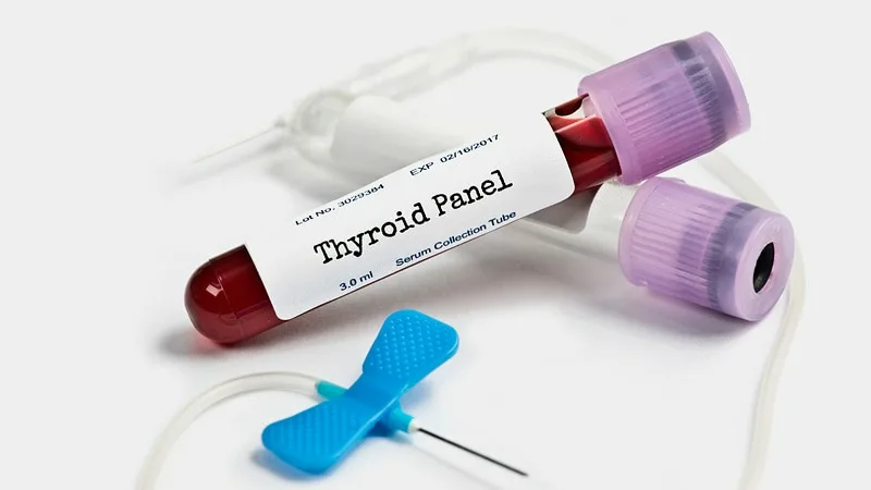 آمادگی قبل آزمایش تیروئید